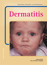  Dermatitis 